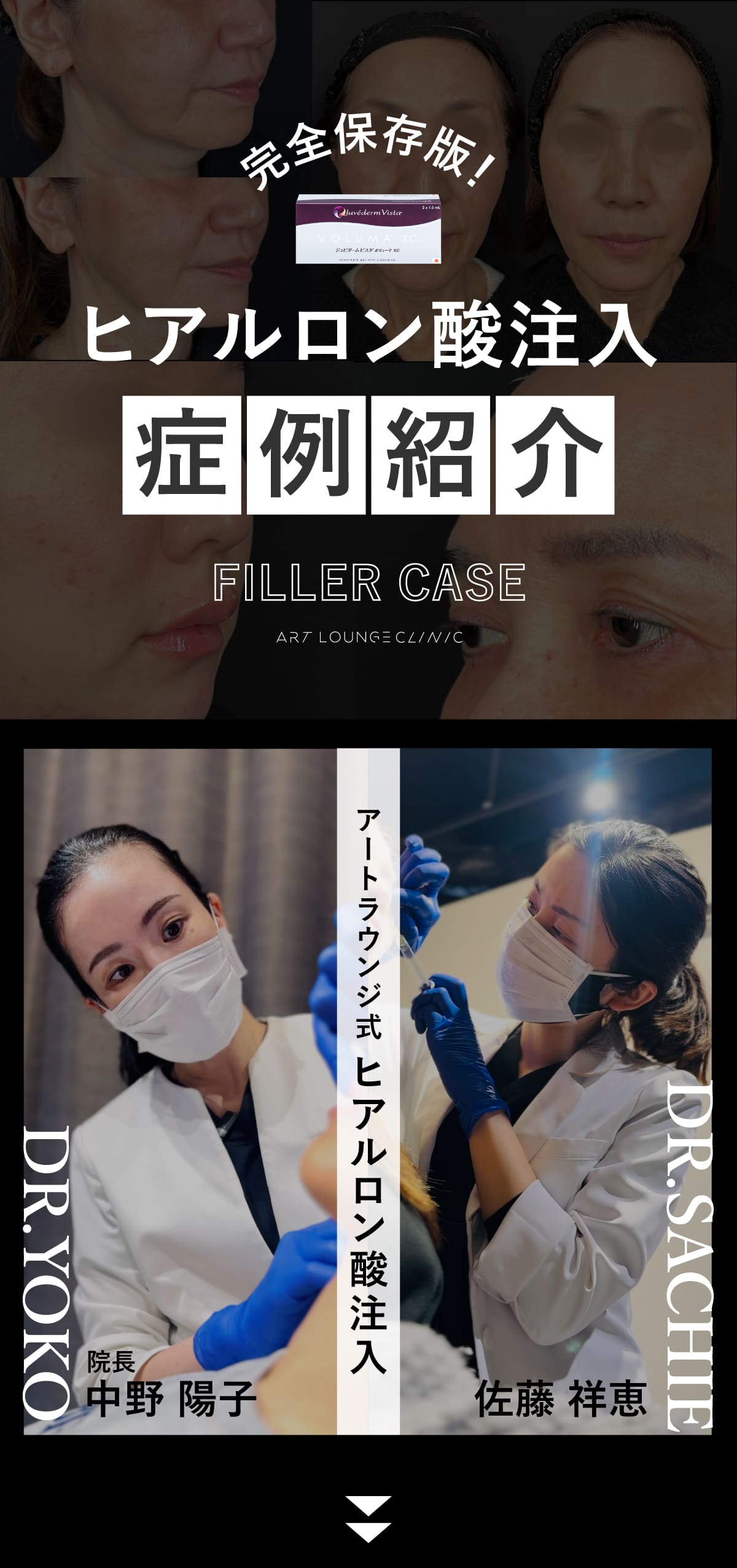 アートラウンジ式ヒアルロン酸注入