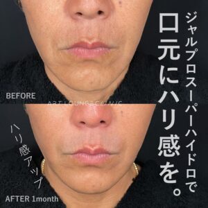 ジャルプロスーパーハイドロ(Jalupro Super Hydro)