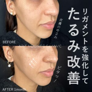 ジャルプロスーパーハイドロ(Jalupro Super Hydro)