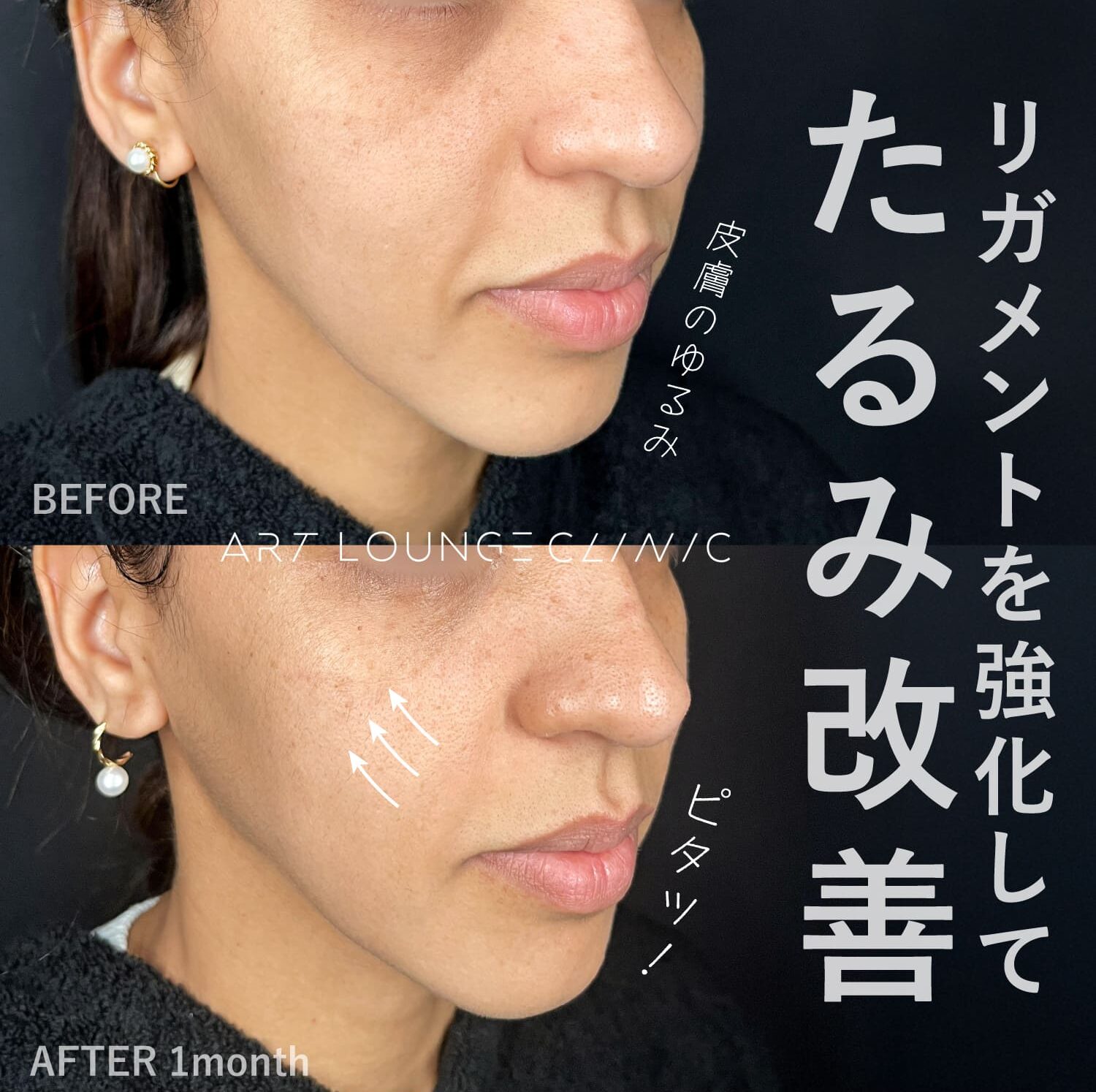 ジャルプロスーパーハイドロ(Jalupro Super Hydro)