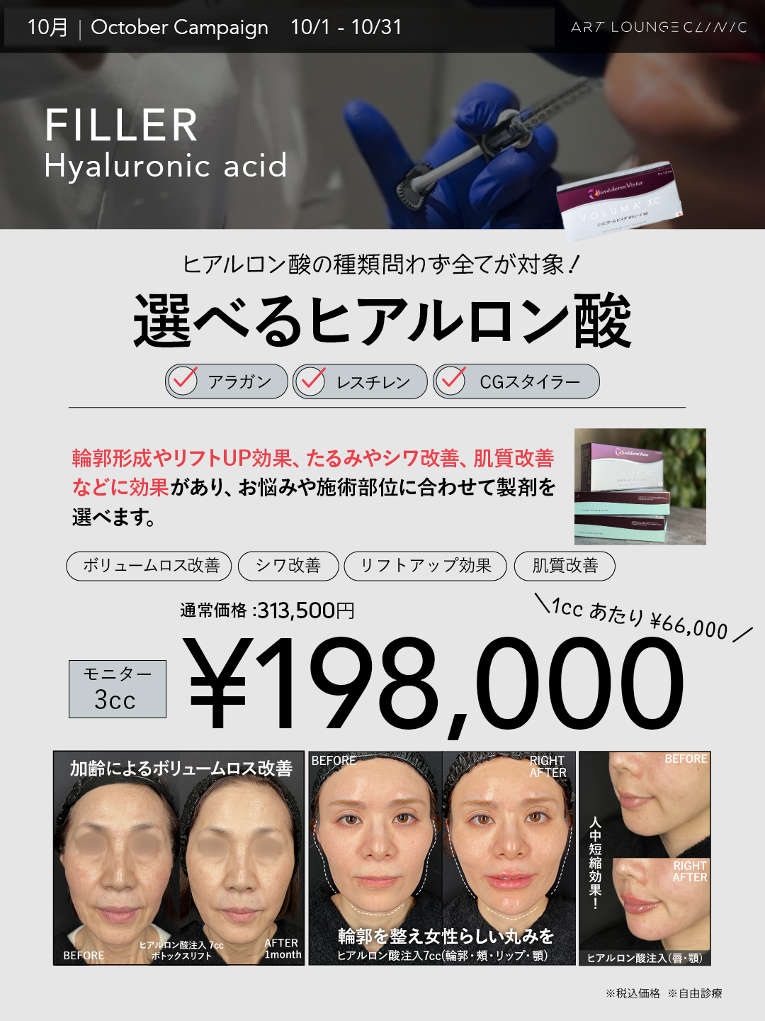 10月キャンペーン 選べるヒアルロン酸3cc モニター価格198,000円（通常価格313,500円・税込）
