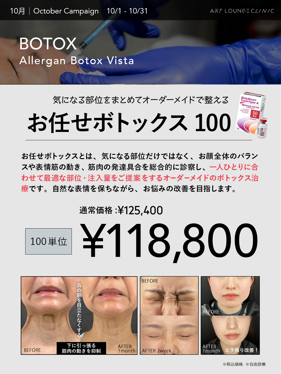 10月キャンペーン お任せボトックス100単位 118,800円（通常価格125,400円・税込）